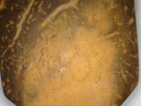 Back of spoon micrograph