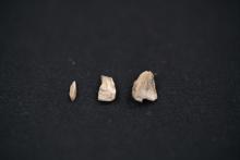 Teeth fragments